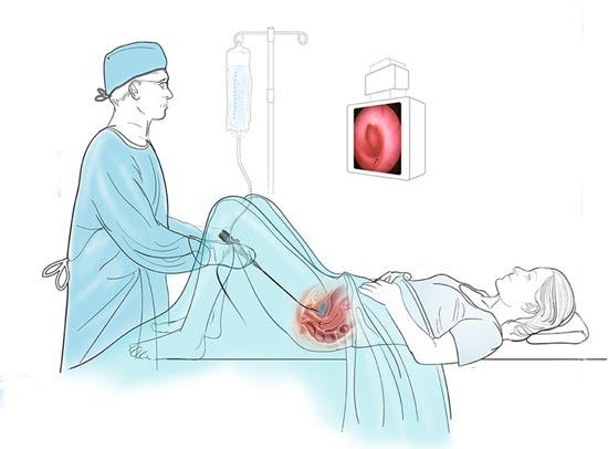 Complex Urological Procedures
